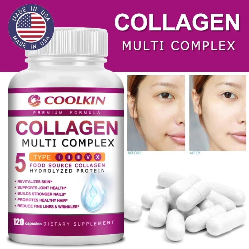 Coffee X - Kollagen-Multi-Komplex – Typen I, II, III,